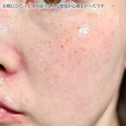 3D PDRN X コラーゲンラッピングマスク/SKIN&LAB/フェイスクリームを使ったクチコミ(5枚目)