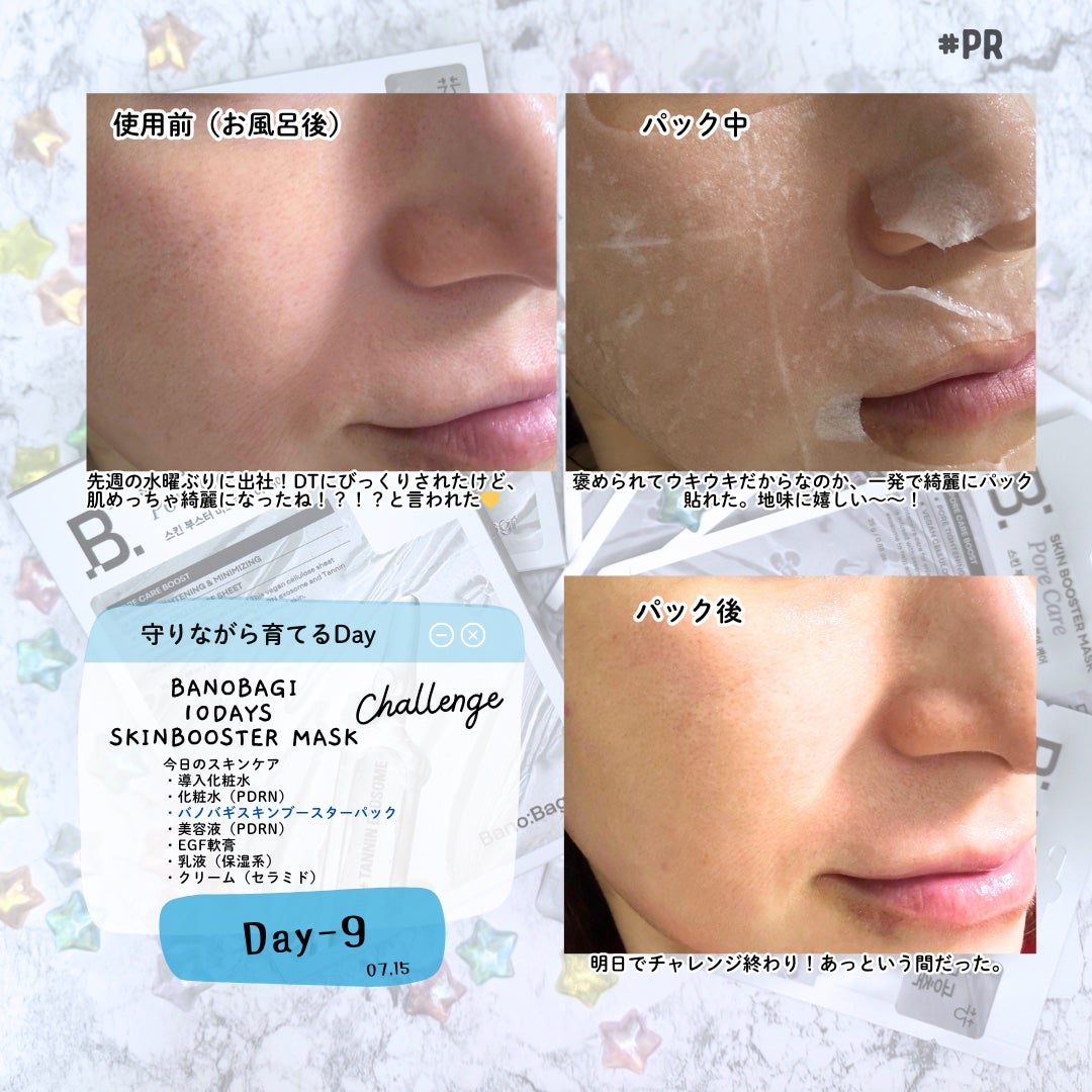 スキンブースターマスクポアケア/BANOBAGI/シートマスク・パックを使ったクチコミ(8枚目)