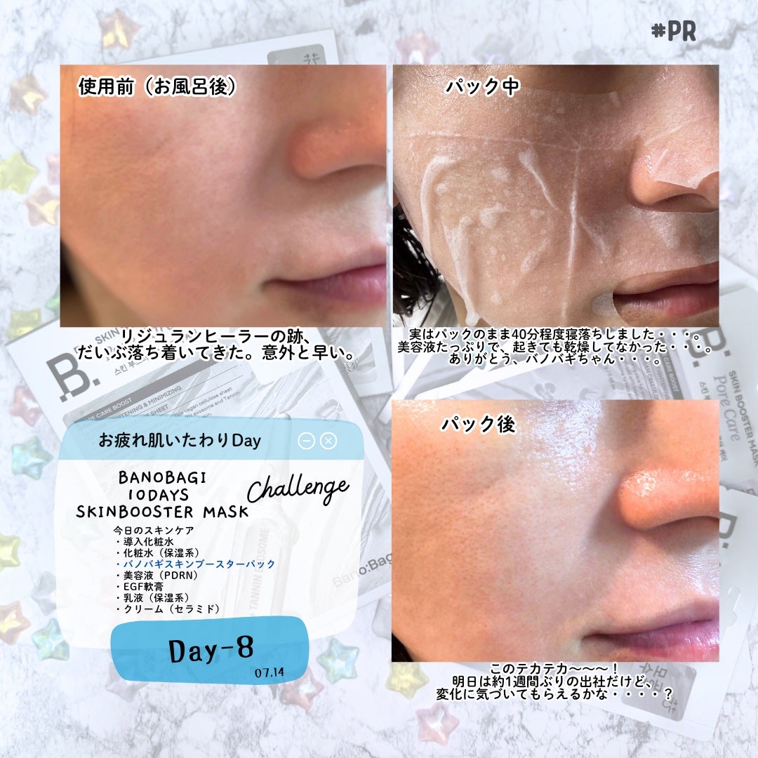 スキンブースターマスクポアケア/BANOBAGI/シートマスク・パックを使ったクチコミ(7枚目)