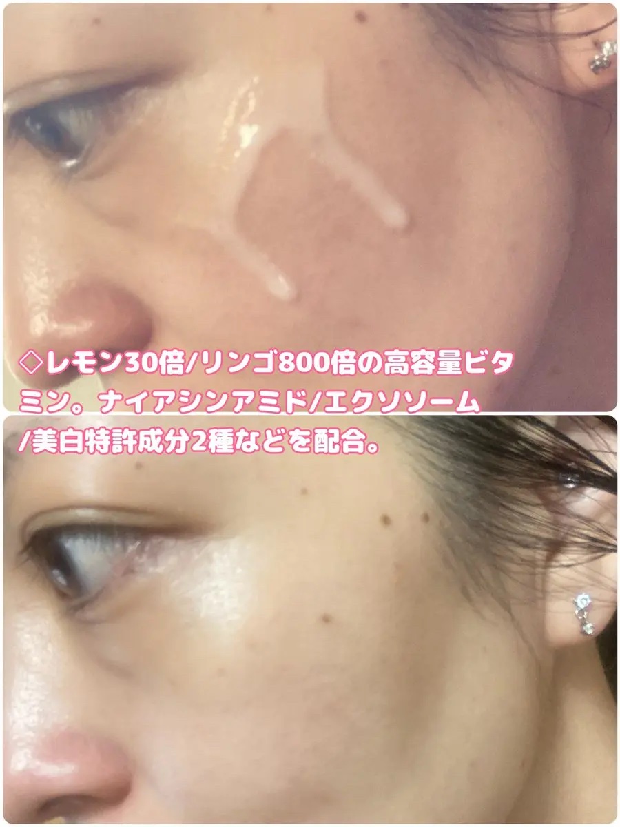 リデンス チェリートーン＆スポットコレクターアンプル/redence/美容液を使ったクチコミ（3枚目）