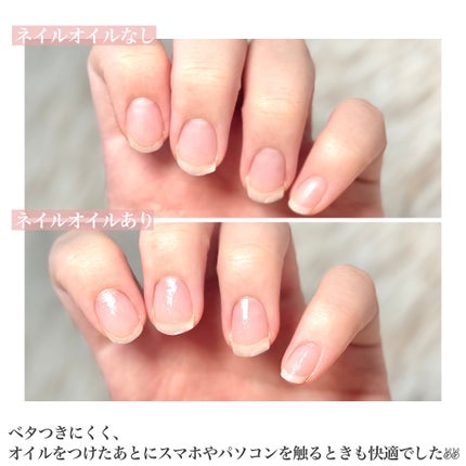 ネイルオイル Ⅲ-layerd/Ceevs./ネイルオイル・トリートメントを使ったクチコミ(6枚目)