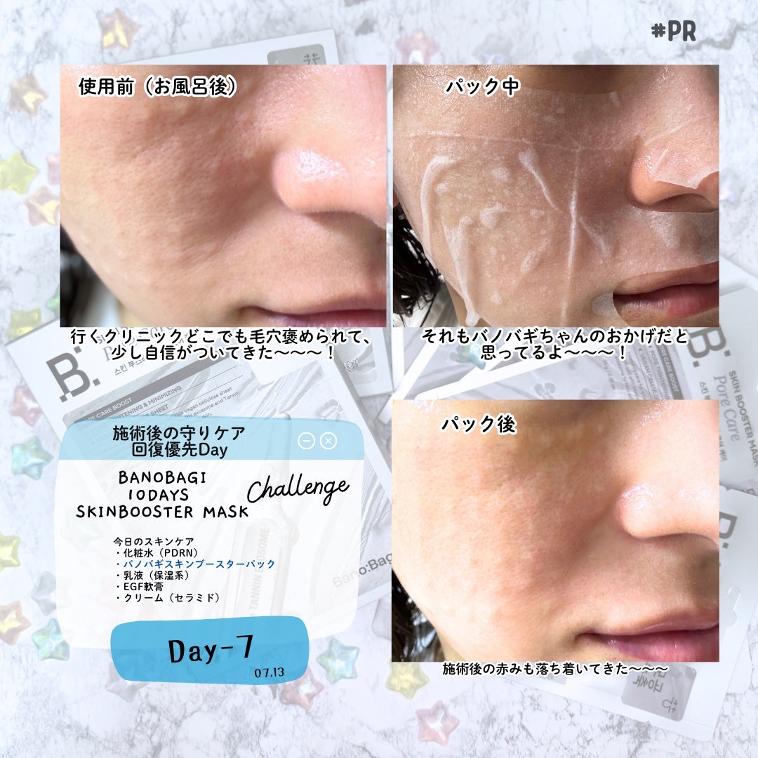 スキンブースターマスクポアケア/BANOBAGI/シートマスク・パックを使ったクチコミ(6枚目)