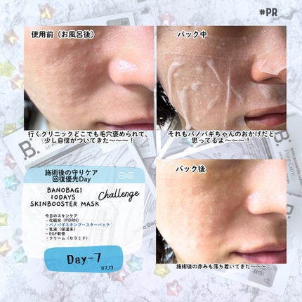スキンブースターマスクポアケア/BANOBAGI/シートマスク・パックを使ったクチコミ(6枚目)
