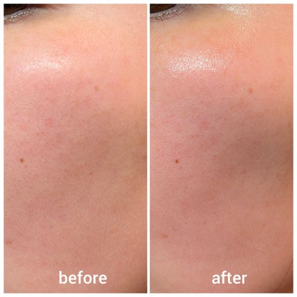 リードルS PDRN+ セラム/VT/美容液を使ったクチコミ(4枚目)