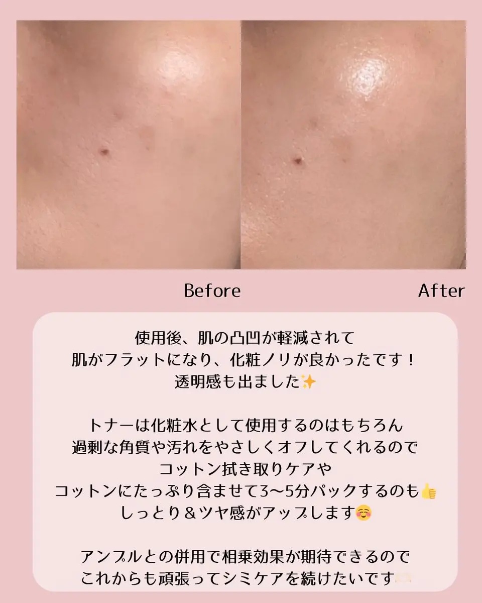 リデンス チェリートーン＆スポットコレクターアンプル/redence/美容液を使ったクチコミ（3枚目）