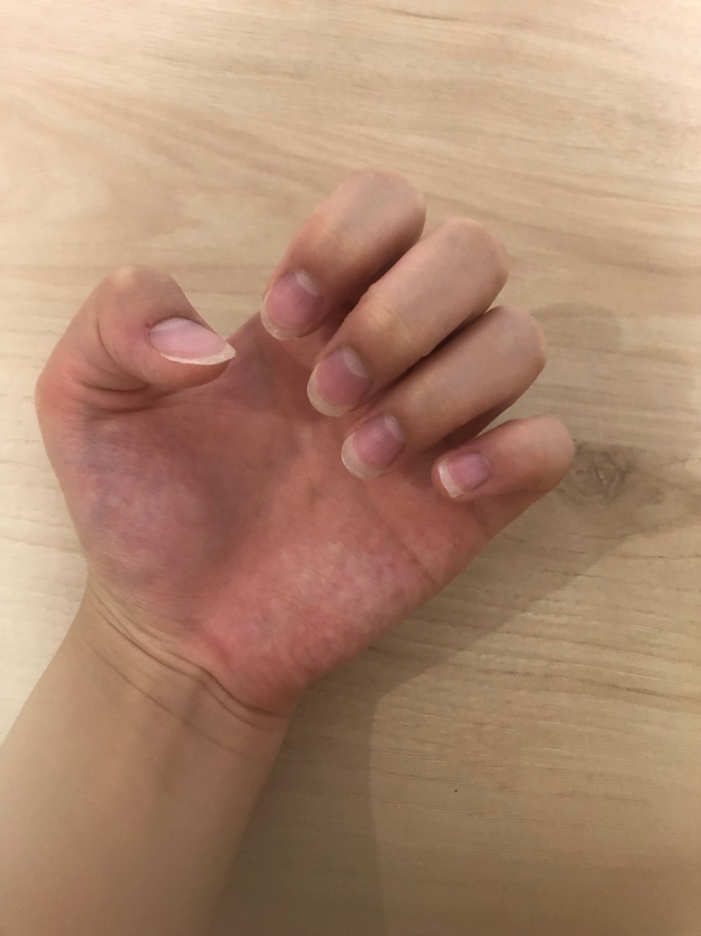 愛羅 on LIPS 「この手を1ヶ月後超絶綺麗な手に変身させます1週間ごとに経過投稿..」(1枚目)