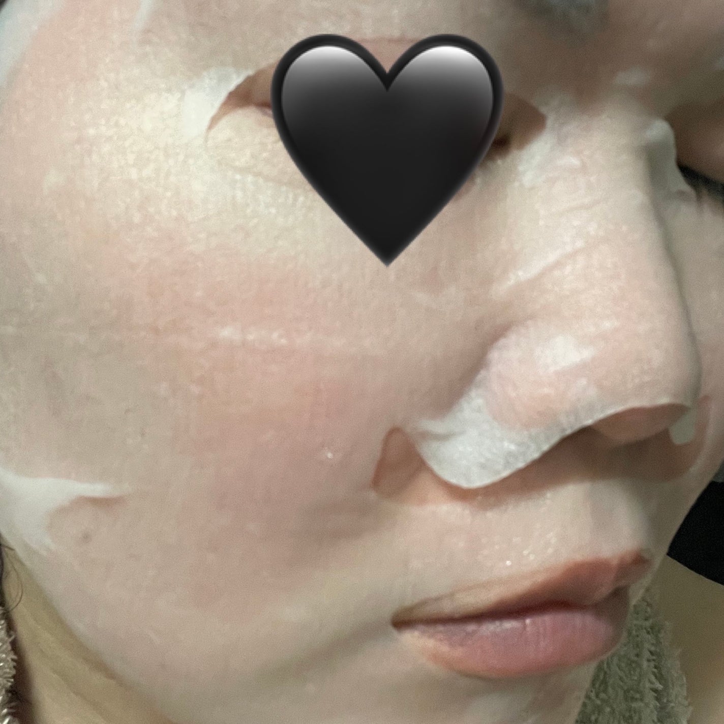 ルルルン ハイドラ EX マスク/ルルルン/シートマスク・パックを使ったクチコミ(4枚目)