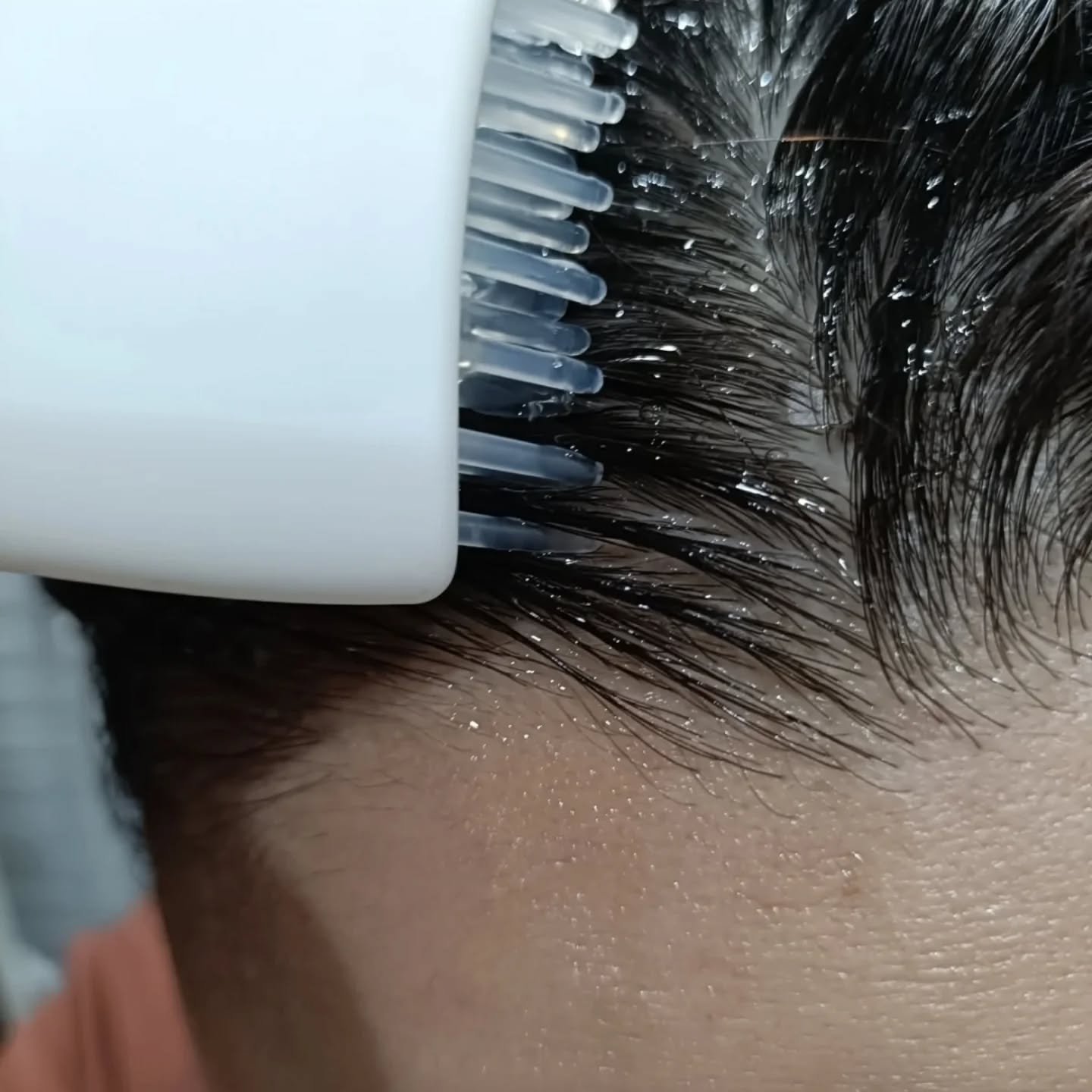 グローターン 100ml/リリーイブ/頭皮ローションを使ったクチコミ（3枚目）