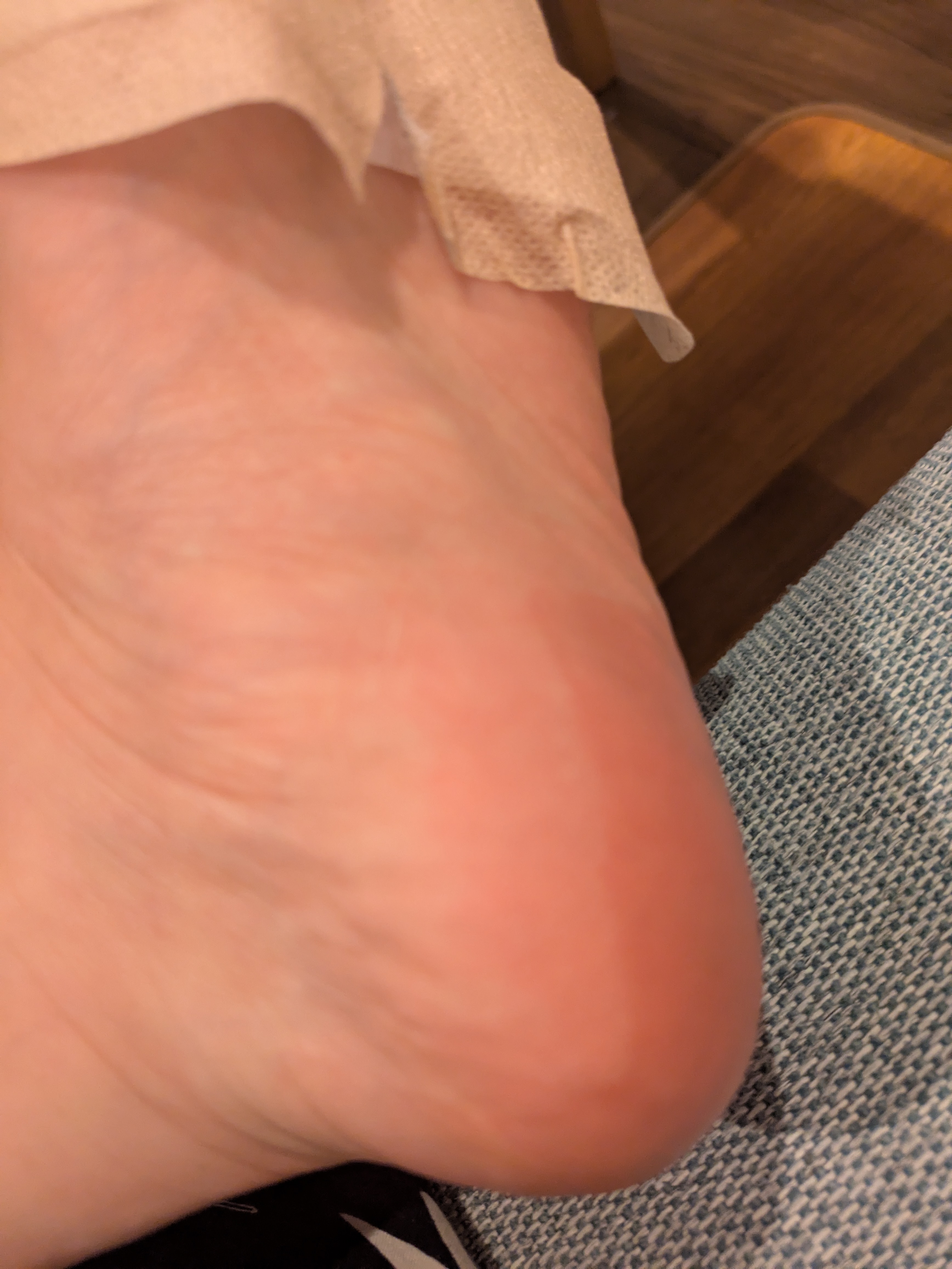 シアバター スリーピング ヒール パッチ/BAREN/レッグ・フットケアを使ったクチコミ（1枚目）