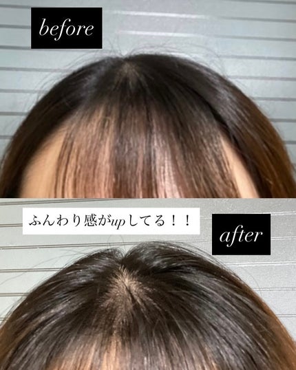 ボリューマイジング&スーディングヘアトニック/SallyZen/頭皮ローションを使ったクチコミ(7枚目)