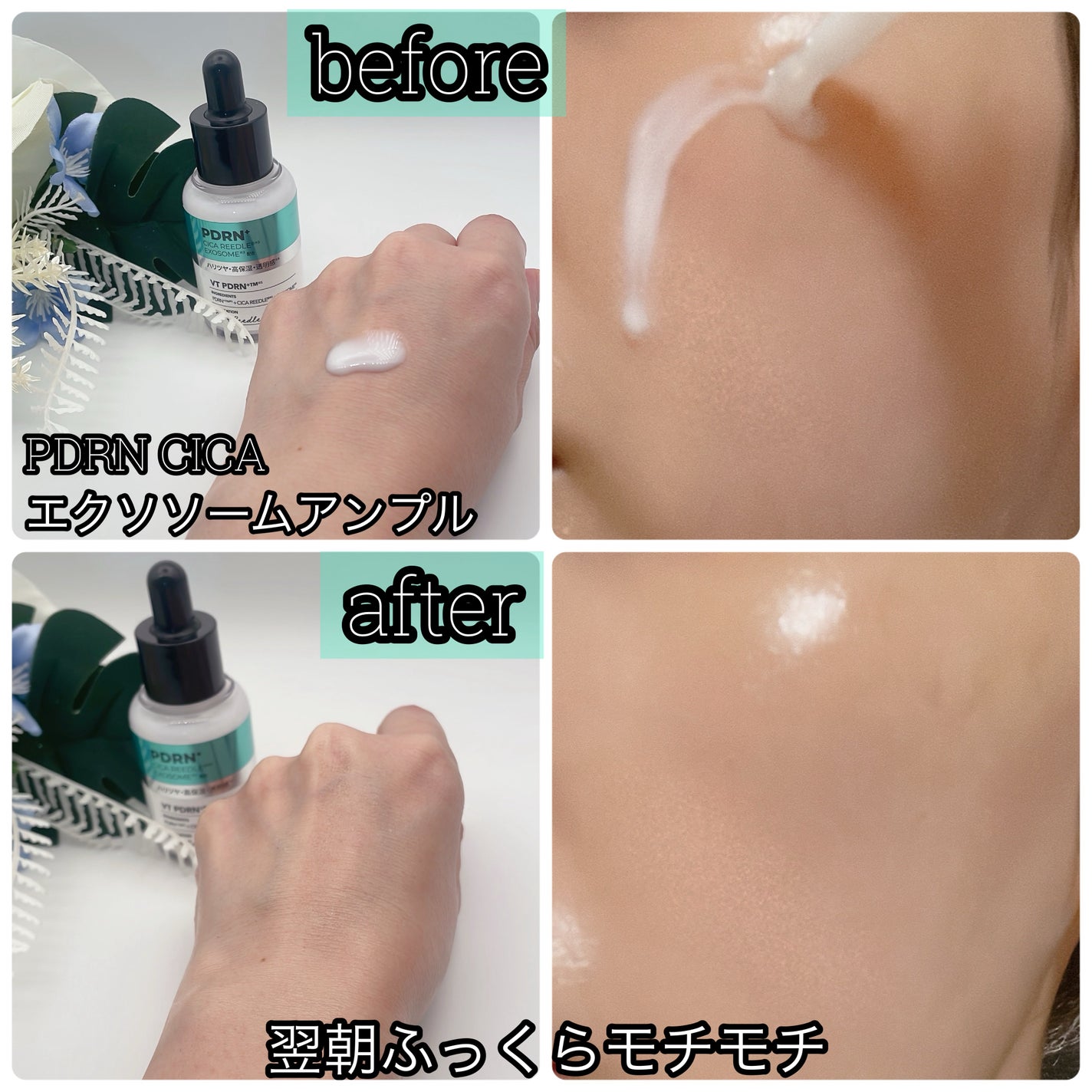 PDRN+リードルS 100/VT/美容液を使ったクチコミ(3枚目)