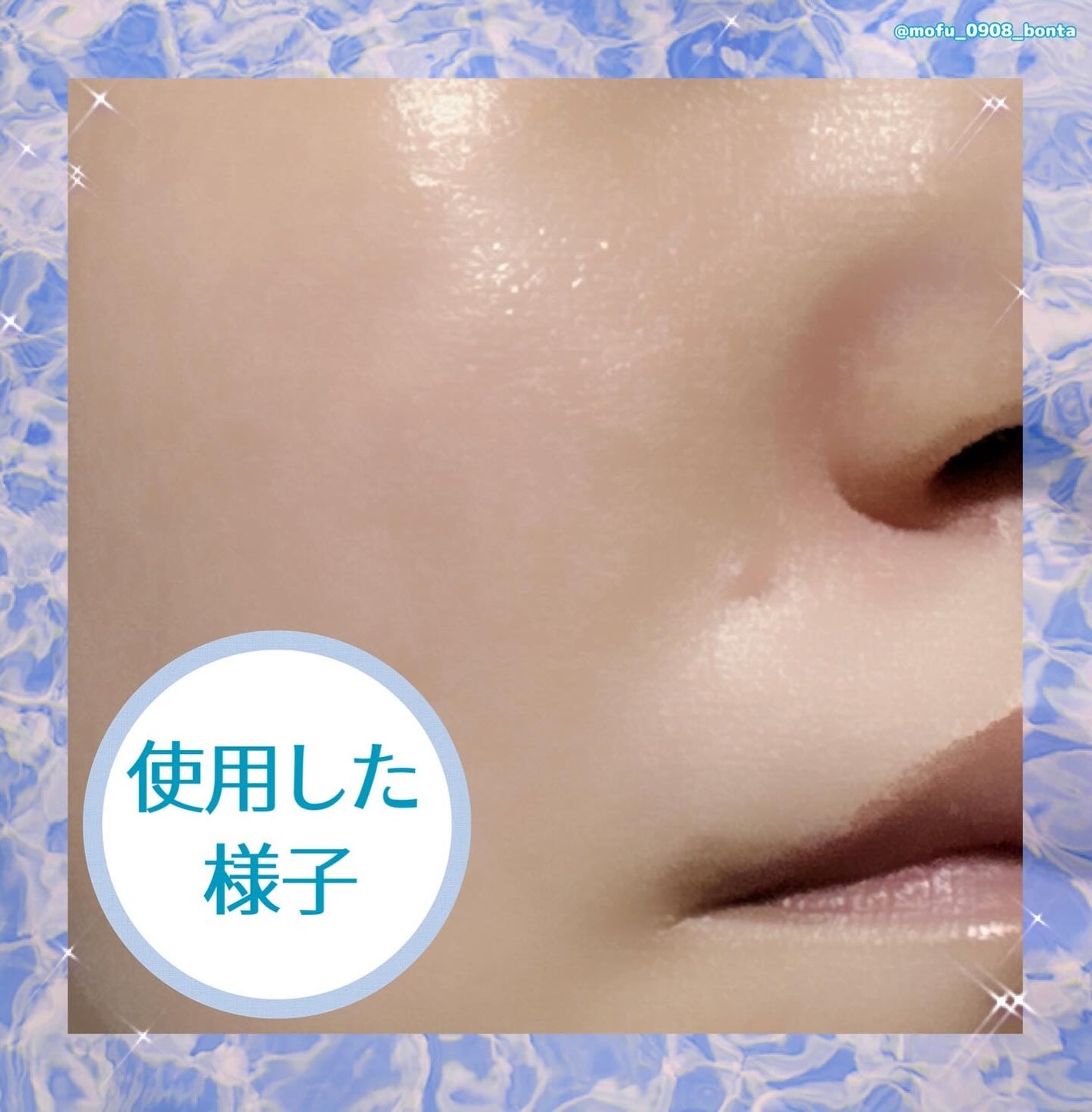 バイオームレメディポアリセットPDRN セラム/UIQ/美容液を使ったクチコミ(5枚目)