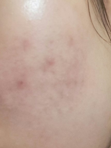 薬用ローション(とてもしっとり)/IHADA/化粧水を使ったクチコミ(2枚目)