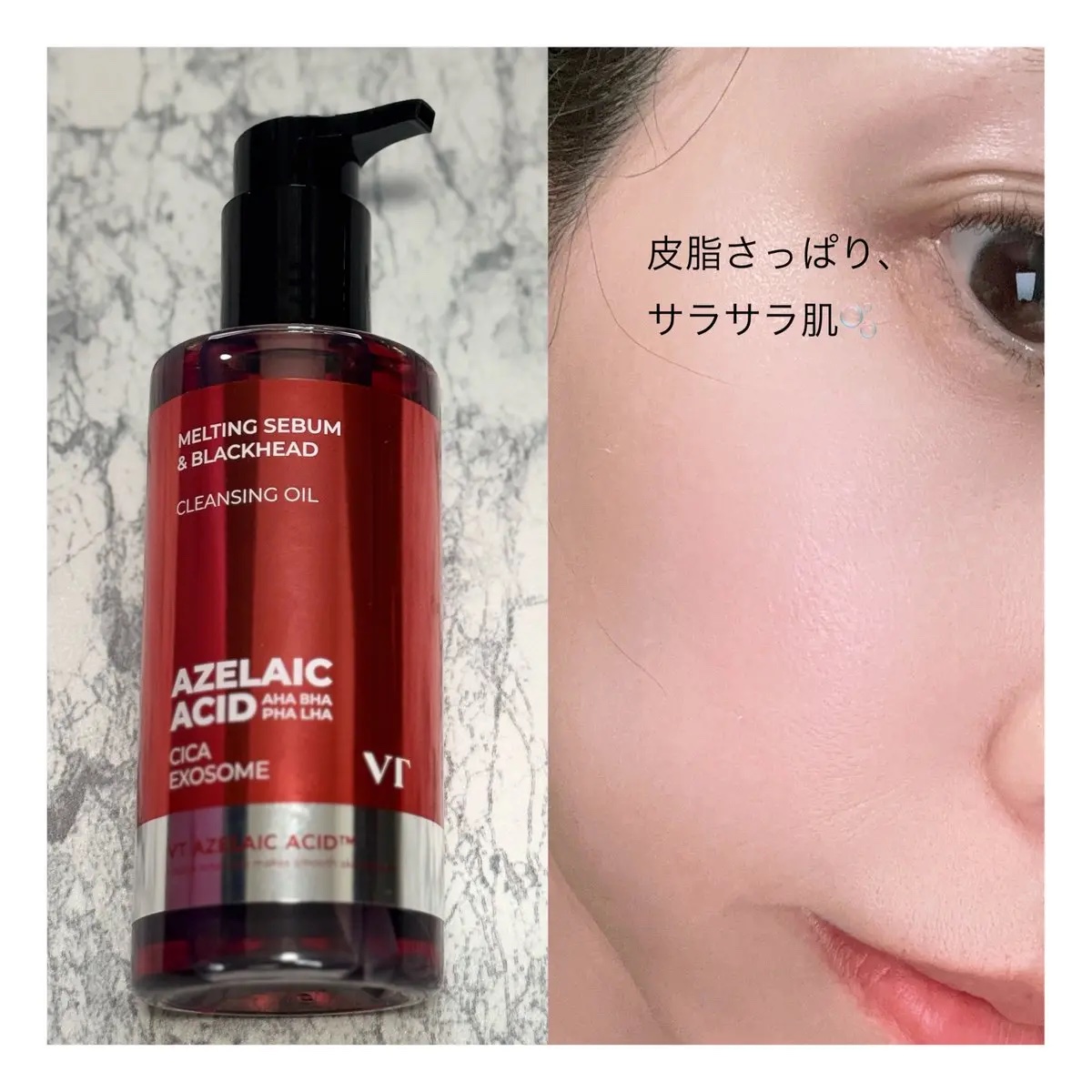 ガーリック リードルショット スポットクリーム/VT/フェイスクリームを使ったクチコミ（2枚目）