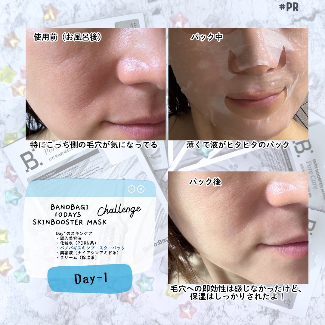 BANOBAGI スキンブースターマスクポアケアのクチコミ「🐻 バノバギ 10日間チャレンジ したよ〜〜🐻#PR

今回チャレンジしたのは…
「バノバギ .....」（2枚目）