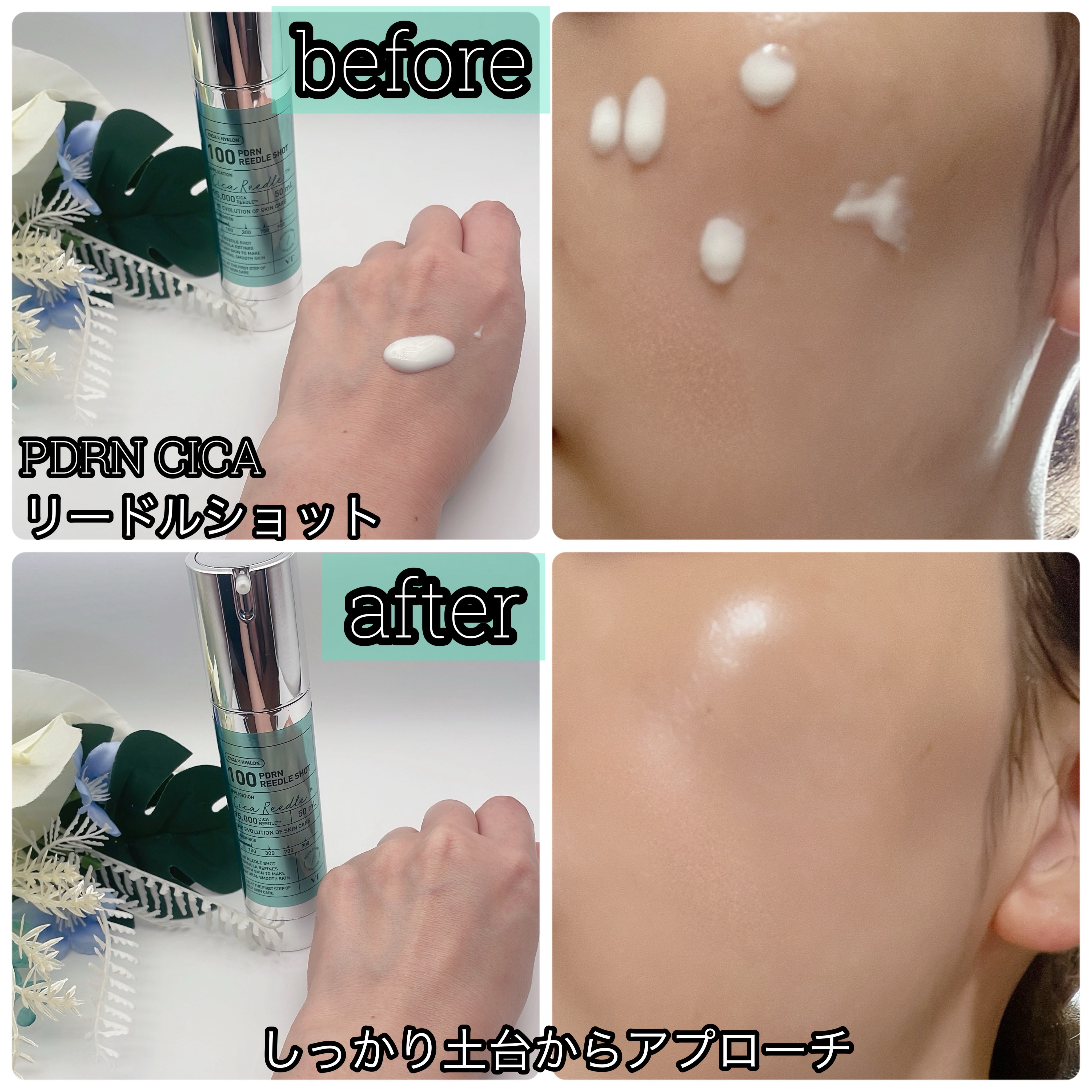PDRN+リードルS 100/VT/美容液を使ったクチコミ（2枚目）