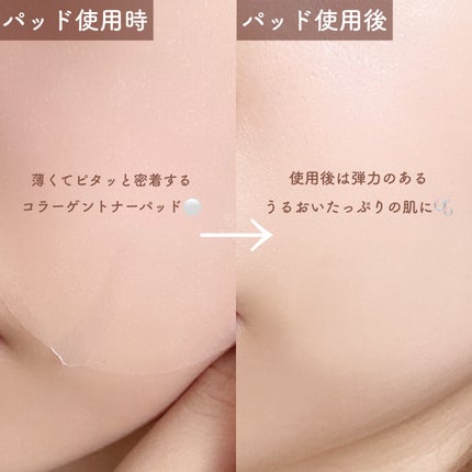 コラーゲントナーパッド/mixsoon/トナーパッドを使ったクチコミ(3枚目)