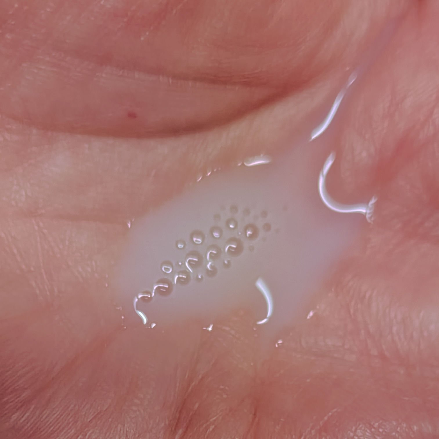 フローラドリップ s/ALBION/化粧水を使ったクチコミ（3枚目）