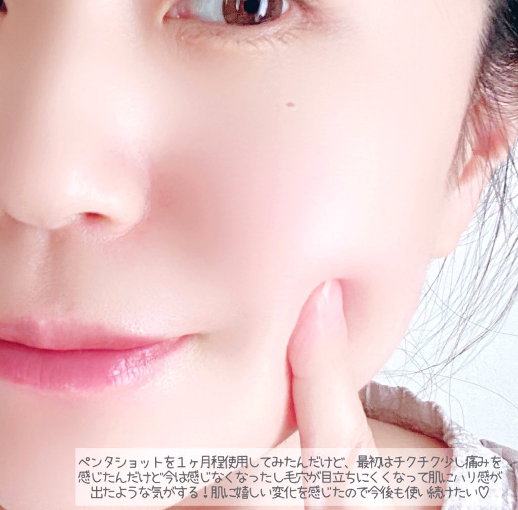 ペンタショット/CELORABY/美顔器・マッサージを使ったクチコミ（3枚目）