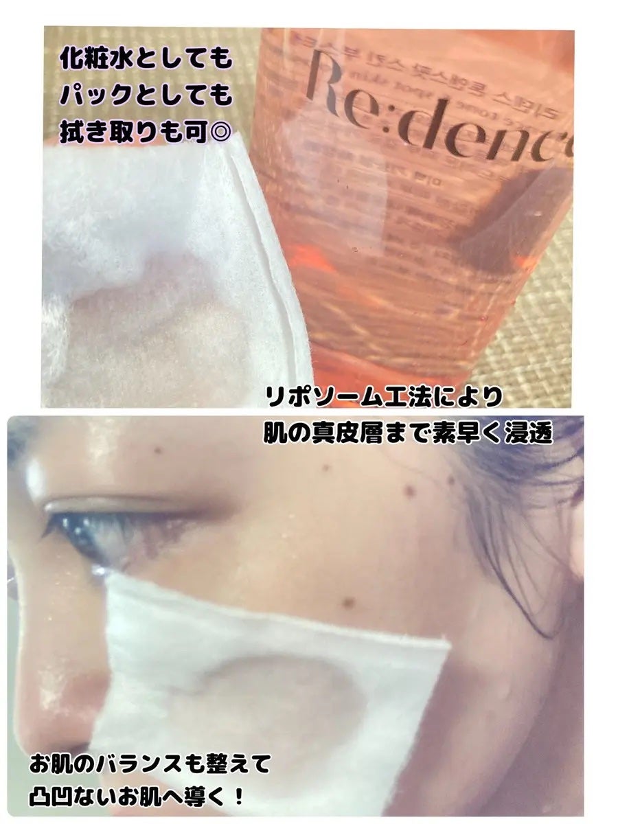 リデンス チェリートーン&スポットスキンブースタートナー/redence/化粧水を使ったクチコミ(2枚目)