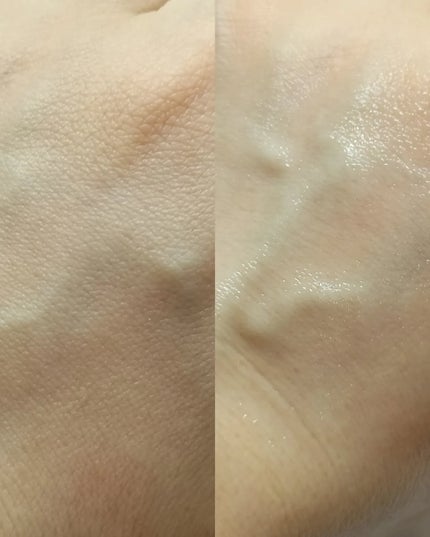 リードルS PDRN+ セラム/VT/美容液を使ったクチコミ(3枚目)