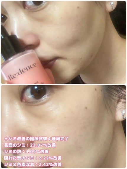 リデンス チェリートーン&スポットコレクターアンプル/redence/美容液を使ったクチコミ(4枚目)