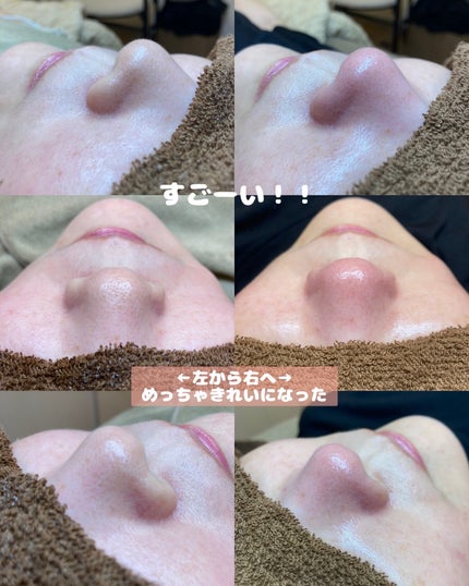 しのち☀️ on LIPS 「全国9人くらいのしのちビューティーファンの皆さまごきげんよう2..」(7枚目)