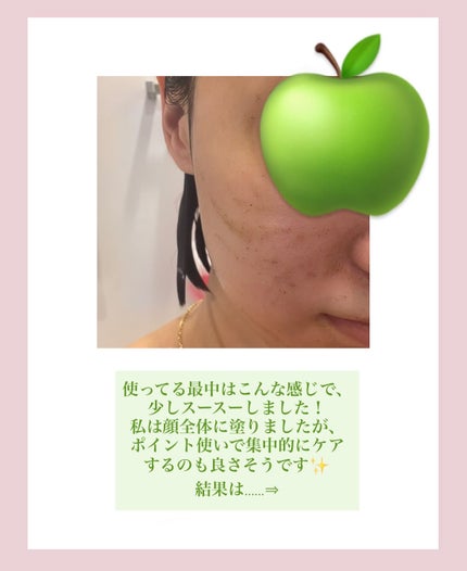 ハーブピーリング/on:myskin/ピーリングを使ったクチコミ(4枚目)