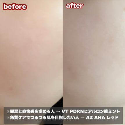 PDRN ヒアルロン酸 ミントマイクロバブルセラム/VT/美容液を使ったクチコミ(4枚目)