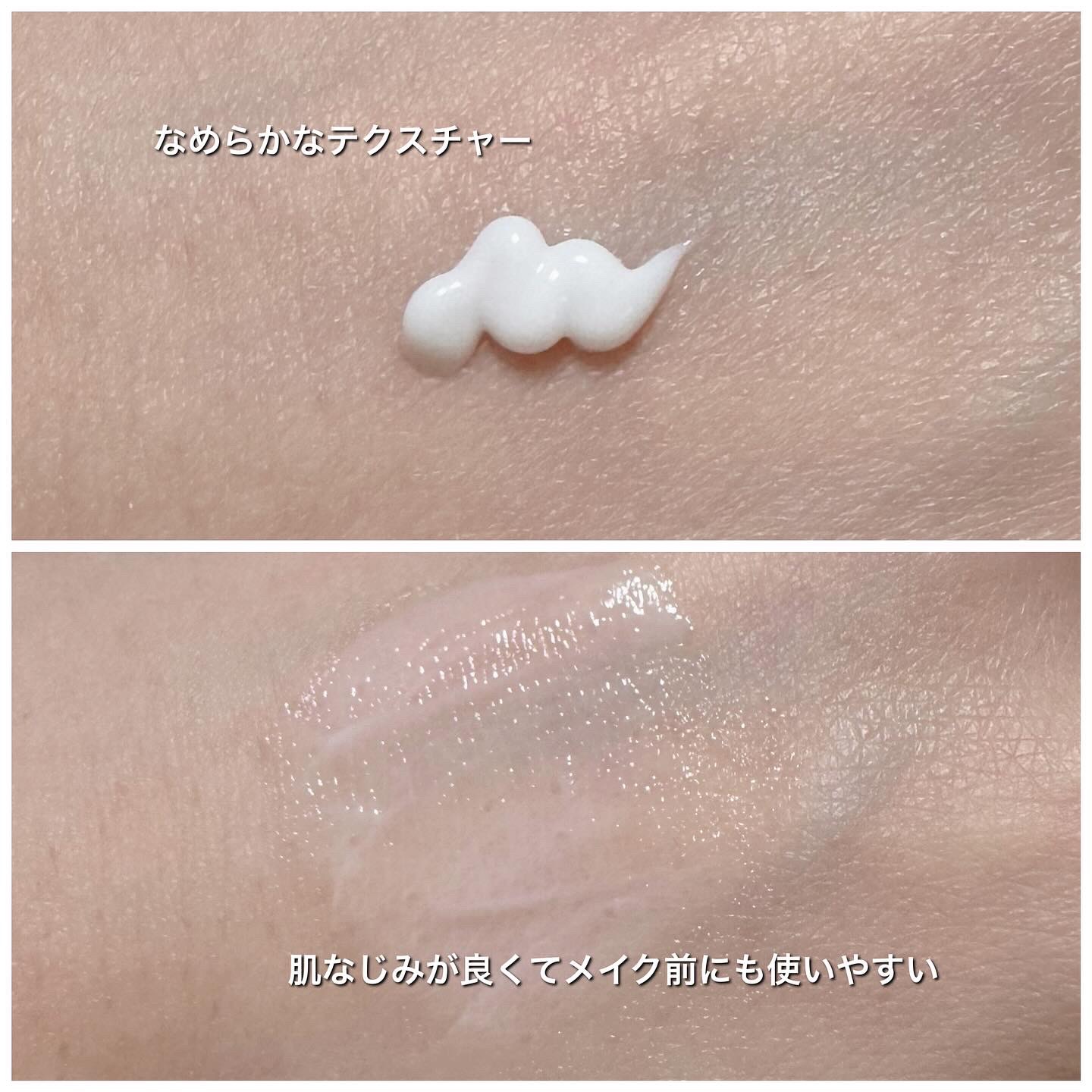 アクノンクリーム/東亜製薬/その他スキンケアを使ったクチコミ（3枚目）