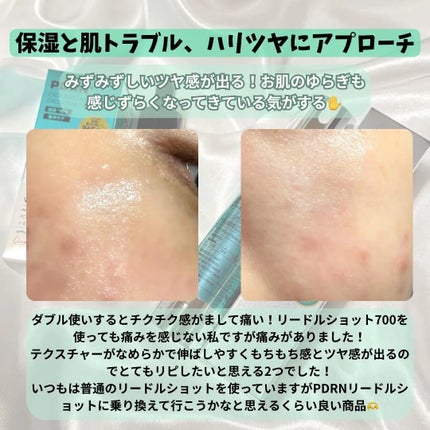 PDRN リードルショット100/VT/ブースター・導入液を使ったクチコミ(4枚目)