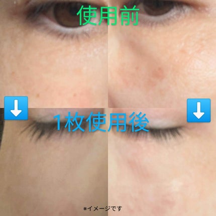 エターナルマイクロパッチ/リュバンブラン/アイケア・アイクリームを使ったクチコミ(5枚目)