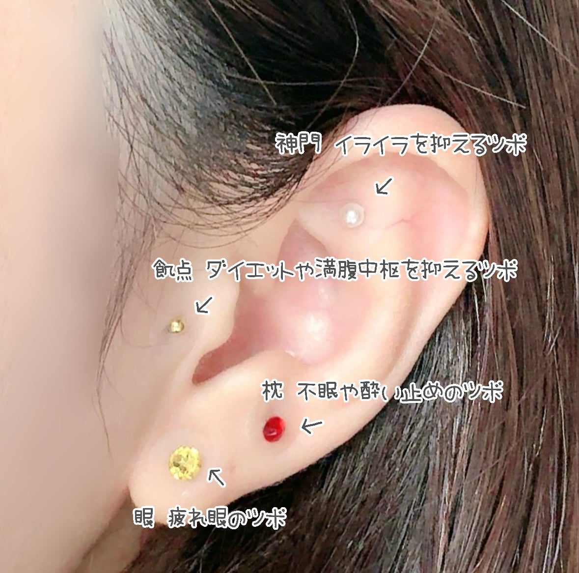 さくら on LIPS 「ピアスみたいにオシャレしながら耳ツボを刺激☺️トップエレガンス..」(2枚目)