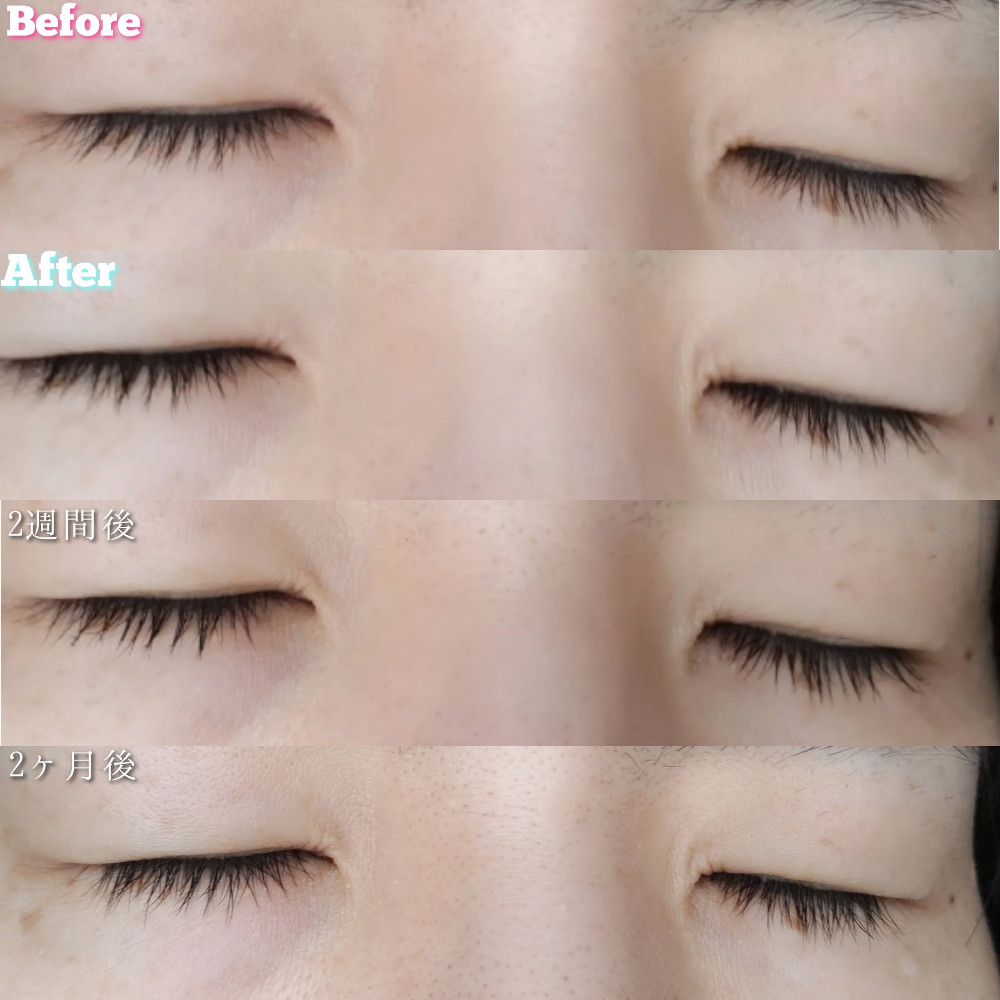 まつげ美容液リッチプラス/CEZANNE/まつげ美容液を使ったクチコミ（3枚目）