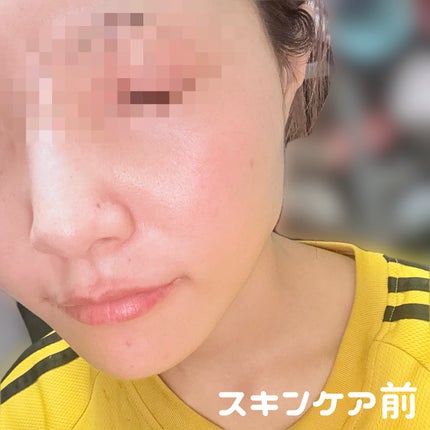 リードルS PDRN+ セラム/VT/美容液を使ったクチコミ(6枚目)