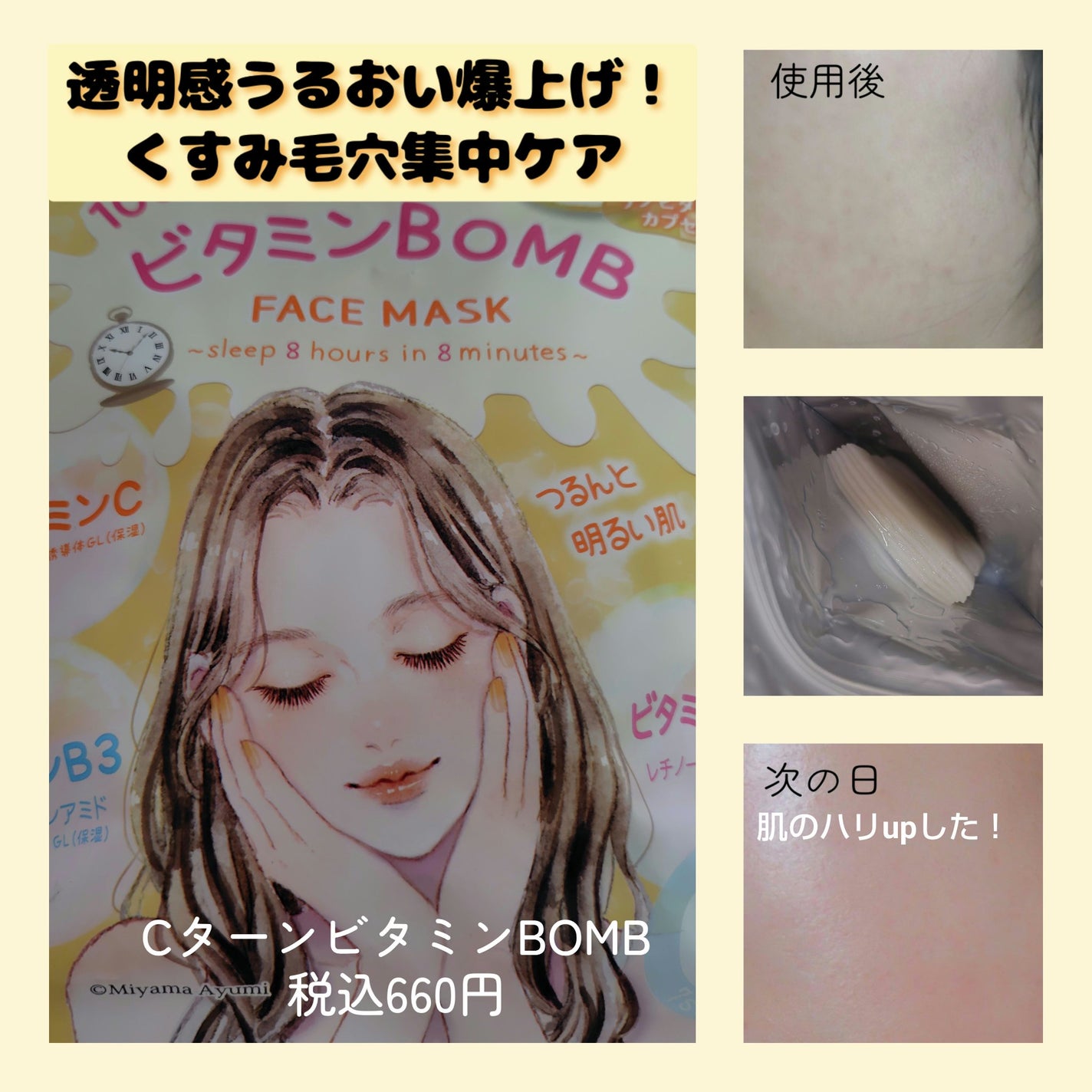 ビタミンBOMBマスク/クリアターン/シートマスク・パックを使ったクチコミ(4枚目)