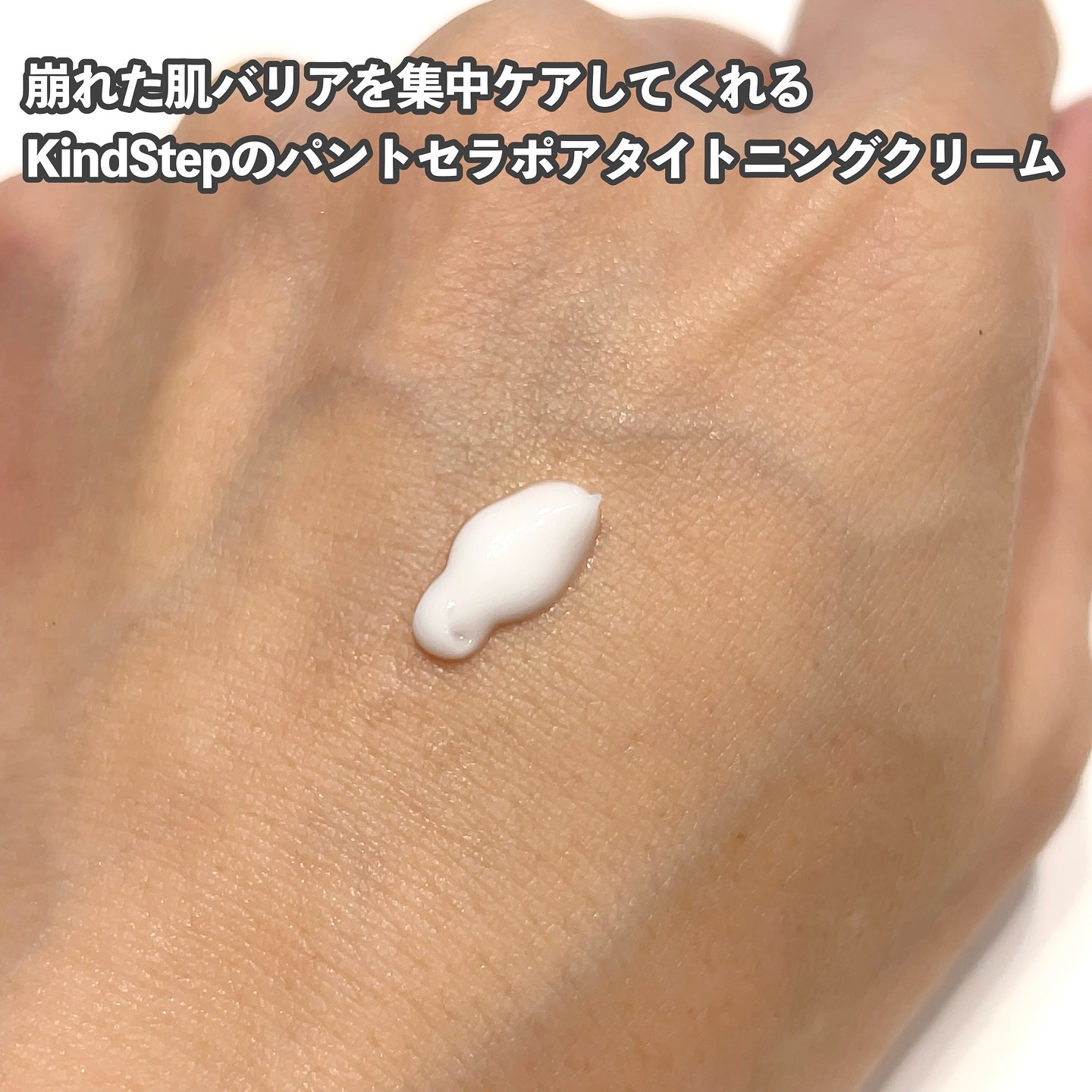 パントセラポアタイットンクリーム/KindStep/フェイスクリームを使ったクチコミ（2枚目）