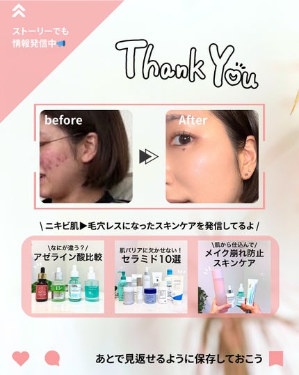 なぎ | スキンケア薬剤師 on LIPS 「その日のケアが何より大事🙏🙏こんばんは、なぎです☀️紫外線を強..」(7枚目)