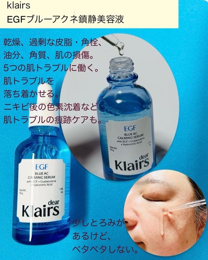 ミッドナイトブルーカーミングクリーム/Klairs/フェイスクリームを使ったクチコミ(4枚目)