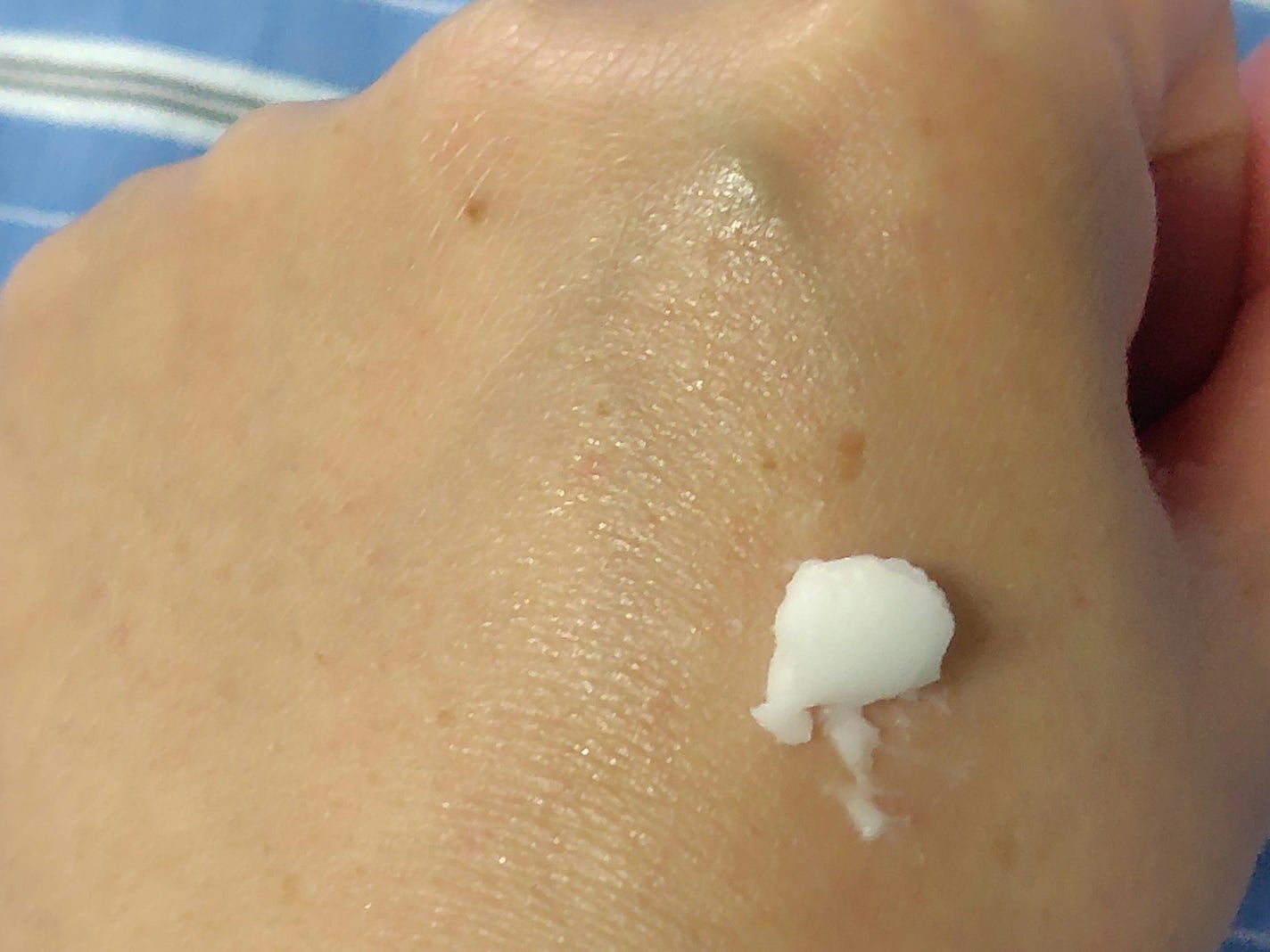 リンクルショット メディカル セラム N/リンクルショット/アイケア・アイクリームを使ったクチコミ(6枚目)