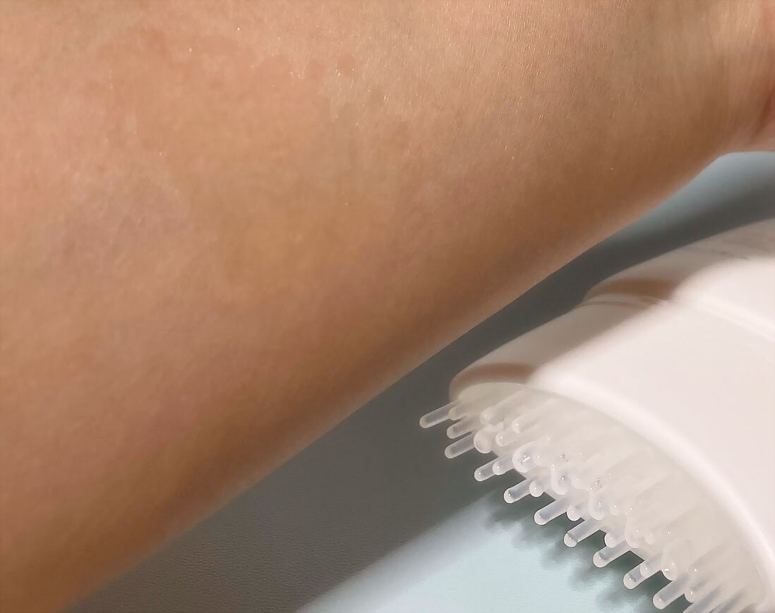 グローターン 100ml/リリーイブ/頭皮ローションを使ったクチコミ(5枚目)