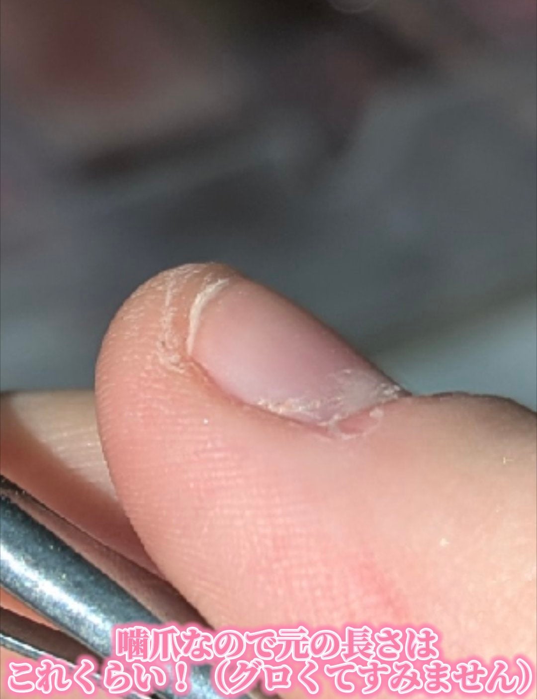 ネイルチップ/SHEIN/ネイルチップ・パーツを使ったクチコミ(2枚目)