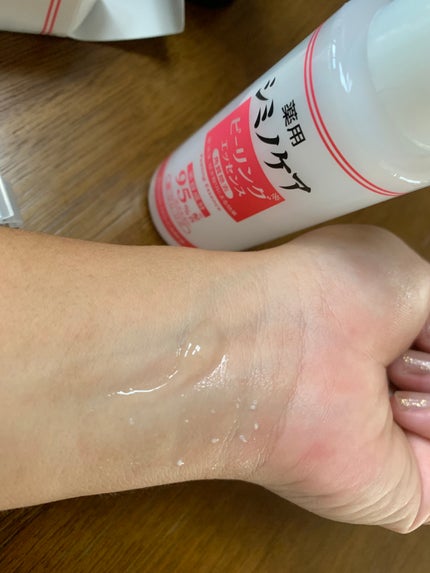 薬用シミノケアピーリングエッセンス/ミリオナ化粧品/ピーリングを使ったクチコミ(4枚目)