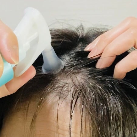 スペシャルケアセット(スキャルプパッチ/育毛トニック)/fasa/頭皮ローションを使ったクチコミ(4枚目)