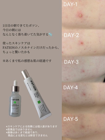 ノスカナイン トラブル セラム/FATION/美容液を使ったクチコミ(2枚目)