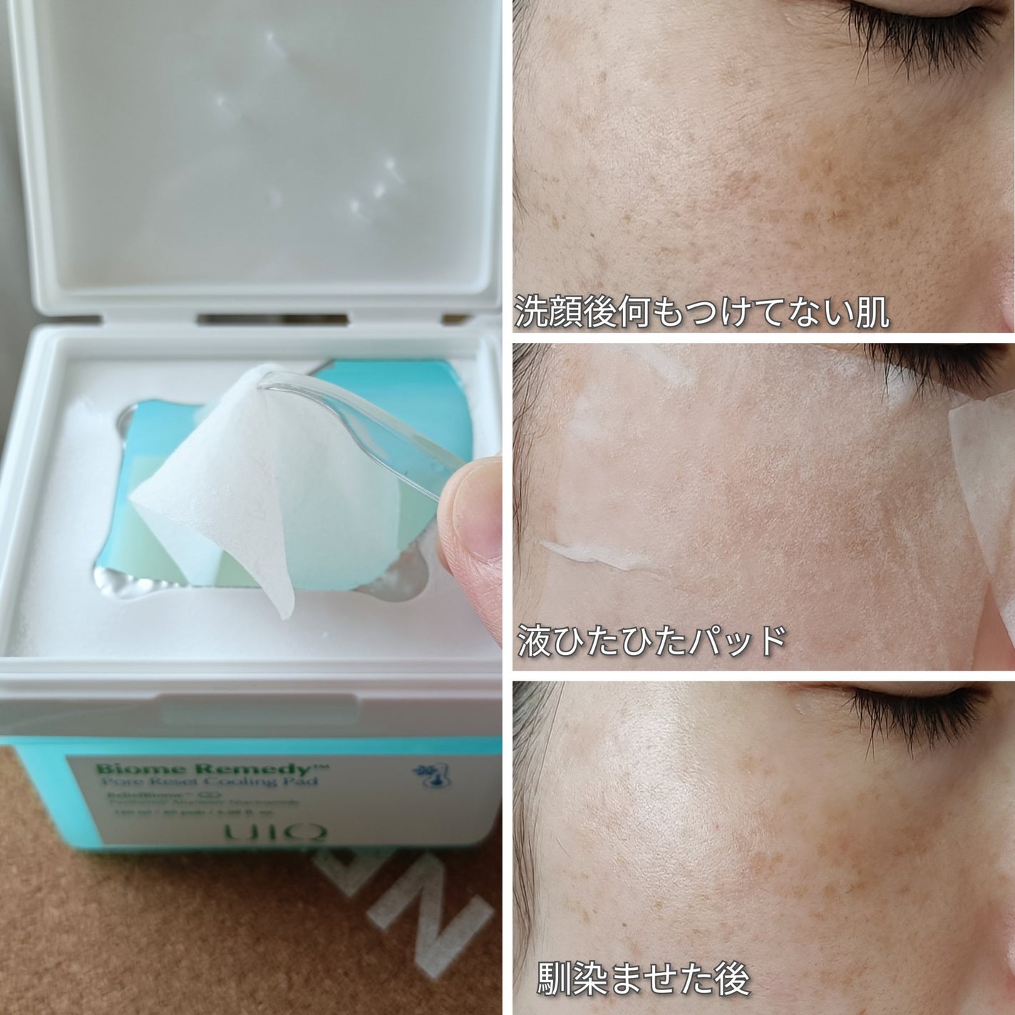 バイオームレメディポアリセットクーリングパッド/UIQ/トナーパッドを使ったクチコミ(3枚目)
