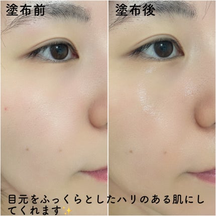 BAKUCHI NEEDLE SHOT DARK CARE AUTO EYE CREAM/LIALUSTER/アイケア・アイクリームを使ったクチコミ(5枚目)