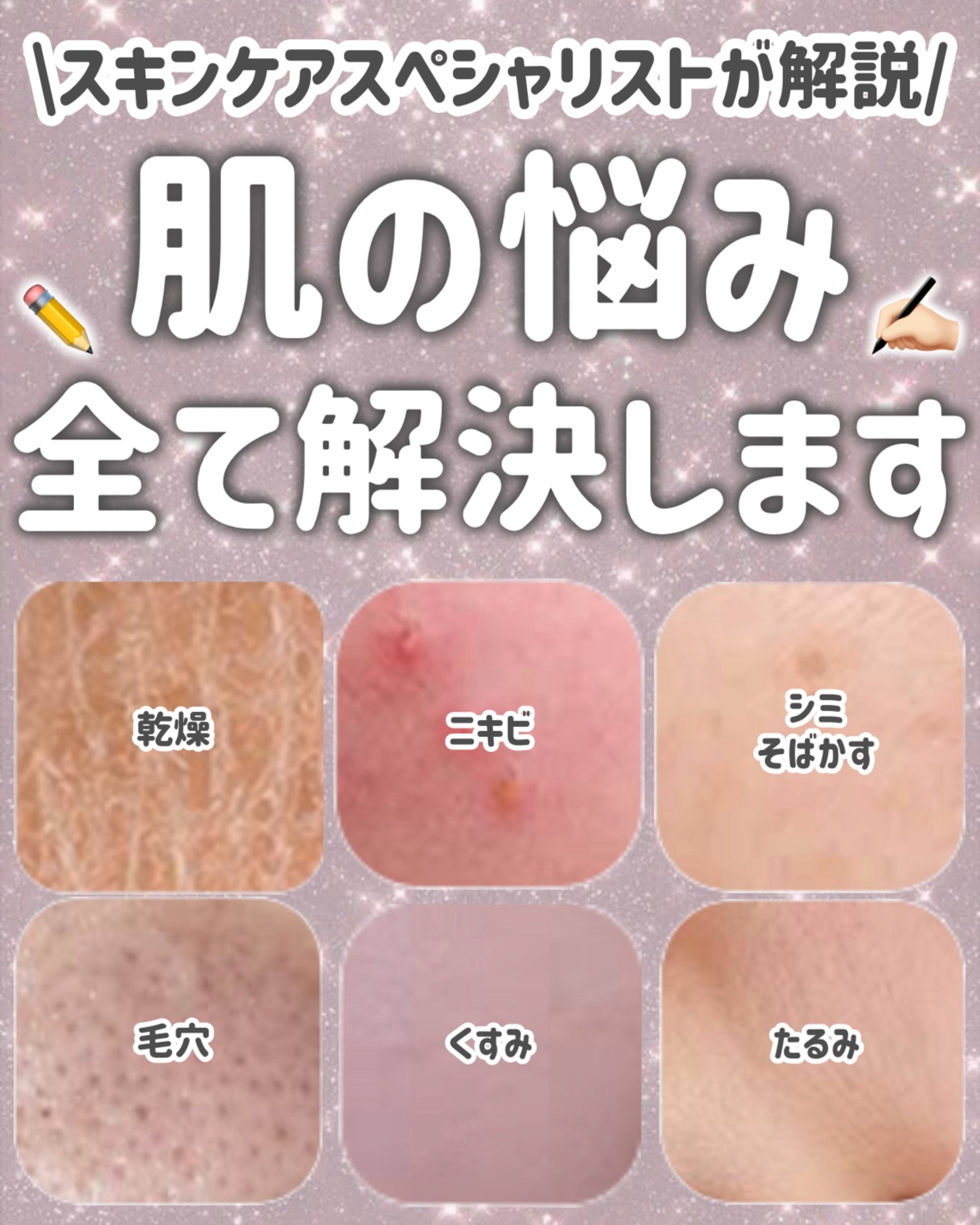 マツキヨ  セラミド化粧水/matsukiyo/化粧水を使ったクチコミ（1枚目）