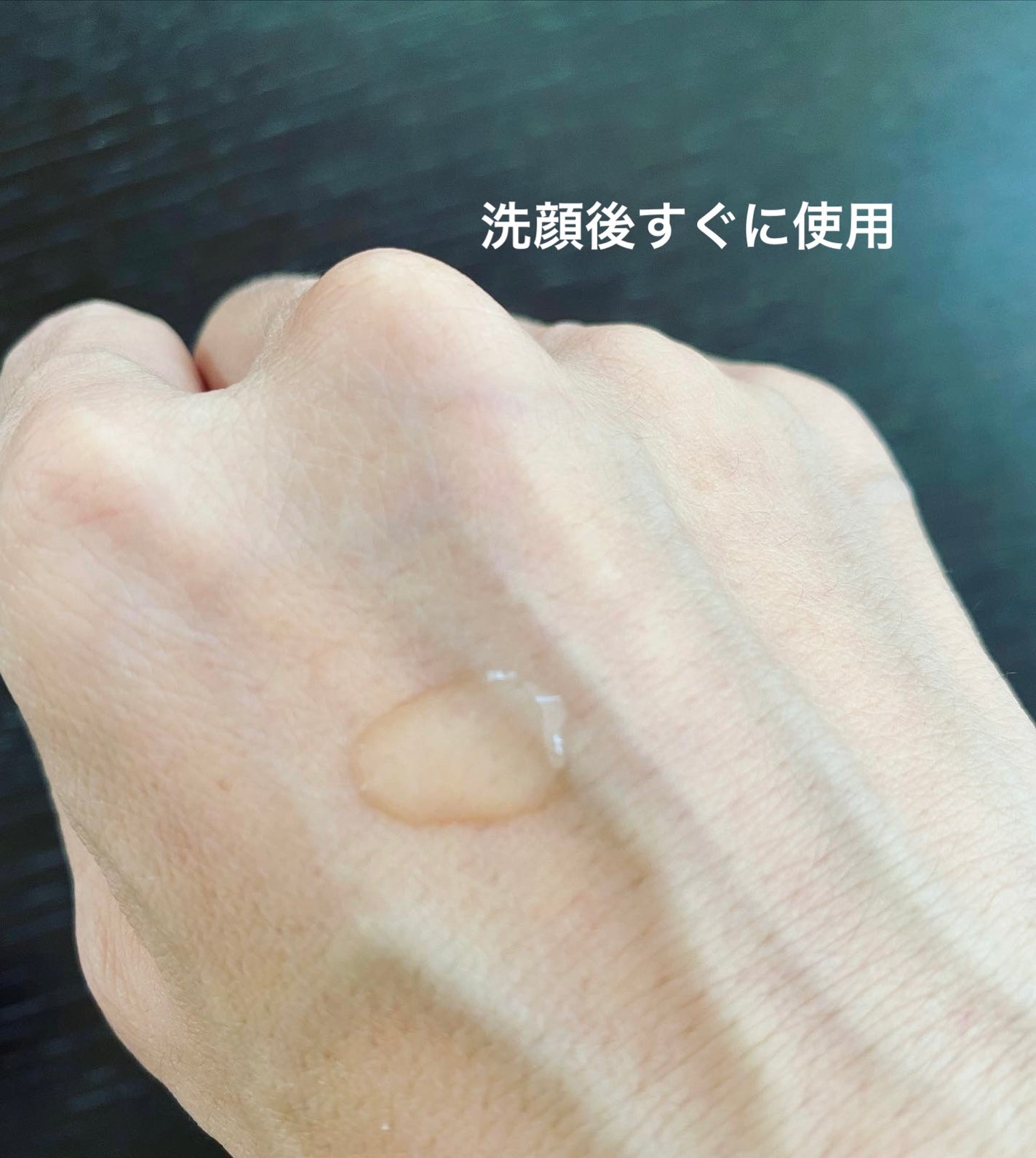 タカミスキンピール/タカミ/ブースター・導入液を使ったクチコミ(4枚目)