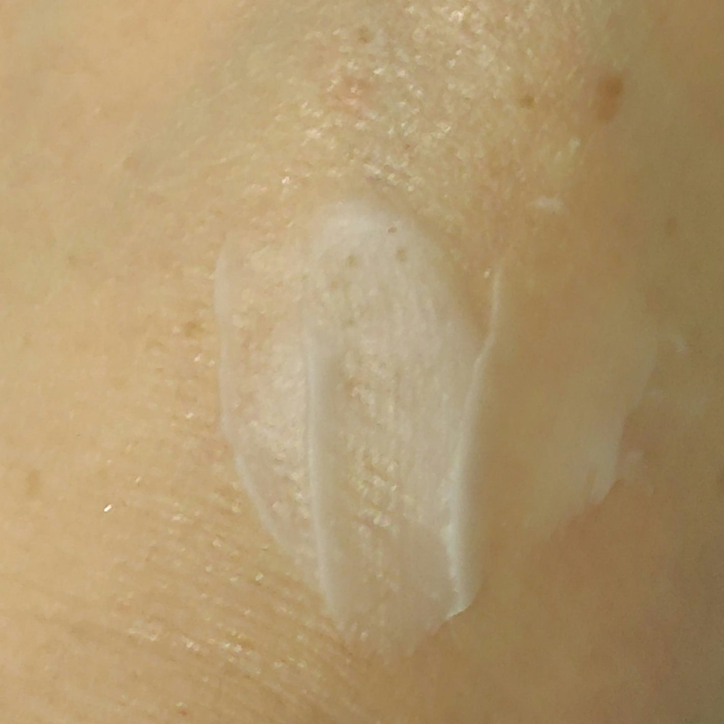 リンクルショット メディカル セラム N/リンクルショット/アイケア・アイクリームを使ったクチコミ(7枚目)